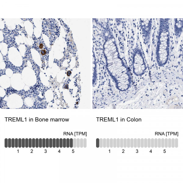 Anti-TREML1