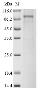 NAD (+) hydrolase SARM1 (SARM1), human, recombinant