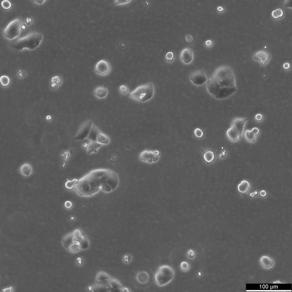 MDA-MB-361 Cells
