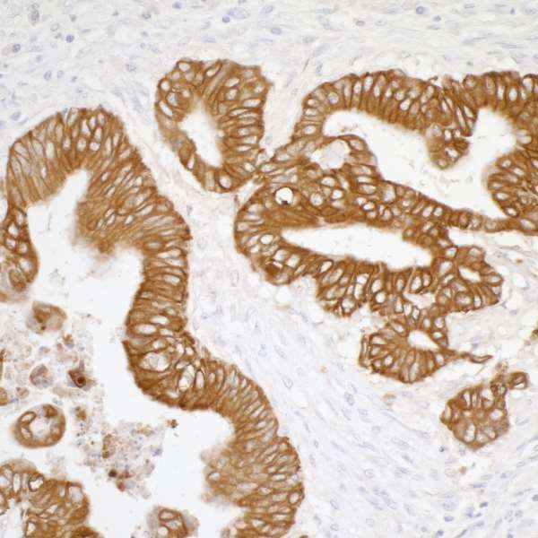 Anti-Cytokeratin Monoclonal