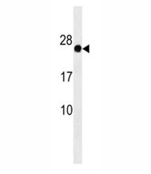 Anti-GAGE12F