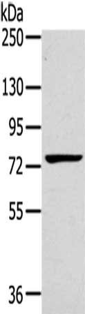 Anti-RHOBTB1