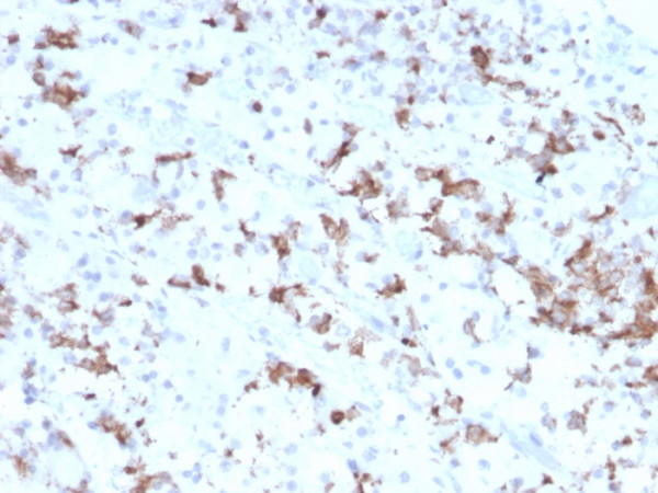 Anti-Prolactin (Pituitary Tumor Marker)(PRL/2641), CF640R conjugate, 0.1mg/mL