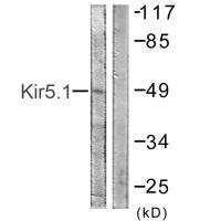 Anti-KCNJ16 (Ab-416)