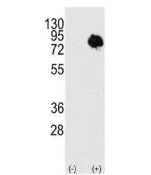 Anti-TG2 / Transglutaminase 2