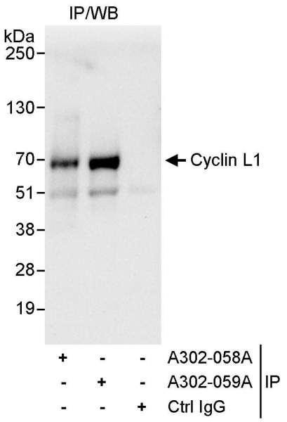 Anti-Cyclin L1