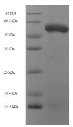 Fibroleukin (FGL2), human, recombinant