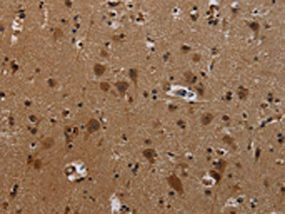 Anti-PCDHB11