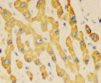 Anti-FDXR / Ferredoxin Reductase