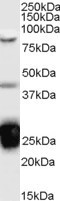 Anti-TIA1, Internal