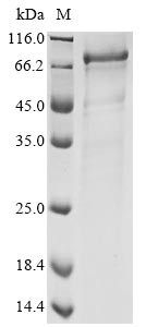 Spike glycoprotein (S), partial, human coronavirus NL63, recombinant