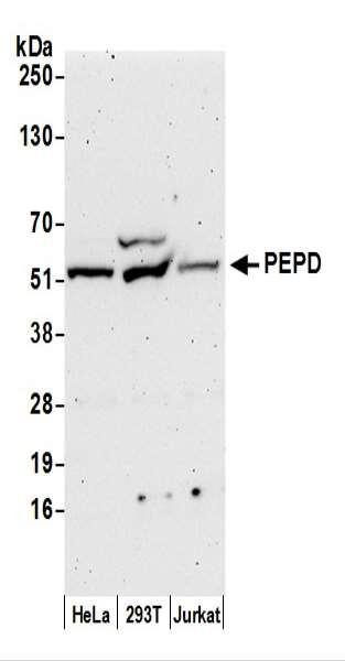 Anti-PEPD