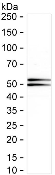 Anti-TGFBR1
