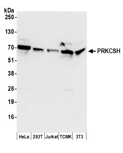 Anti-PRKCSH
