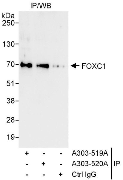 Anti-FOXC1