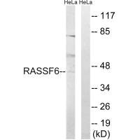 Anti-RASSF6