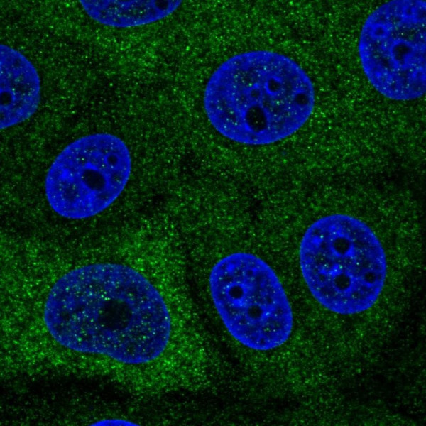 Anti-PABPC1L