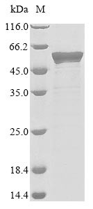 Nucleoprotein (N), human coronavirus HKU1, recombinant
