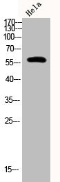 Anti-Phospho-PFKFB2 (S483)