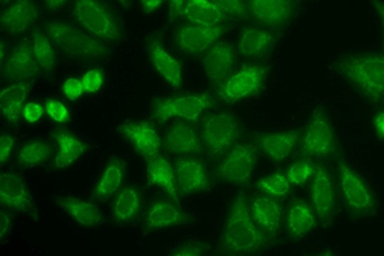 Anti-SMPD1 / Acid Sphingomyelinase