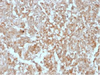Anti-DOG-1/TMEM16A (Gastrointestinal Stromal Tumor Marker) Recombinant Mouse Monoclonal Antibody (cl