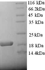 Alpha-2-macroglobulin (A2m), partial, rat, recombinant