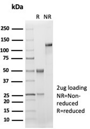 Anti-CD33 / SIGLEC3 (Myeloid Cell Surface Antigen), recombinant antibody, clone SIGLEC3/7046R