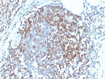 Anti-CD6, clone C6/2884R