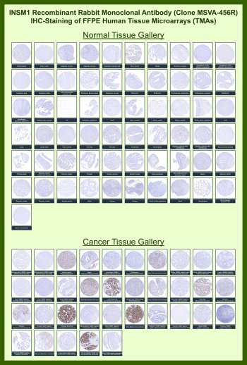Anti-INSM1 / Insulinoma-associated 1, clone MSVA-456R