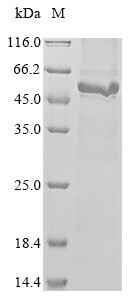 Extracellular tyrosine-protein kinase PKDCC (Pkdcc), mouse, recombinant