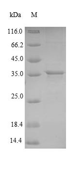 Adenylate kinase (adk), Mycobacterium tuberculosis, recombinant