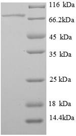 Pigment epithelium-derived factor (Serpinf1), rat, recombinant