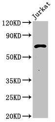 Anti-Pcsk2