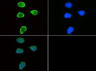 Anti-trimethyl-Histone H3 (Trimethyl Lys9)