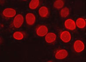 Anti-BRG1, clone 6D7-F7-B6