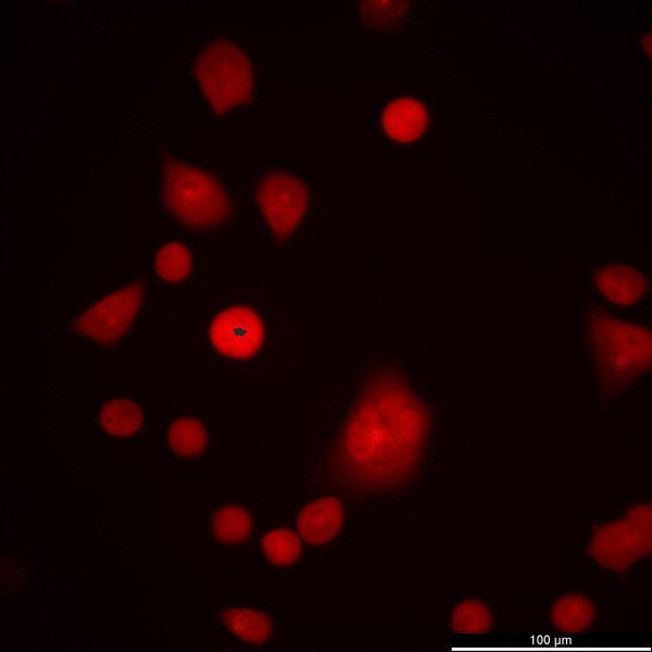 NCI-H1299-RFP Cells