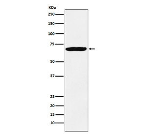 Anti-IGF2BP3, clone AEDB-9