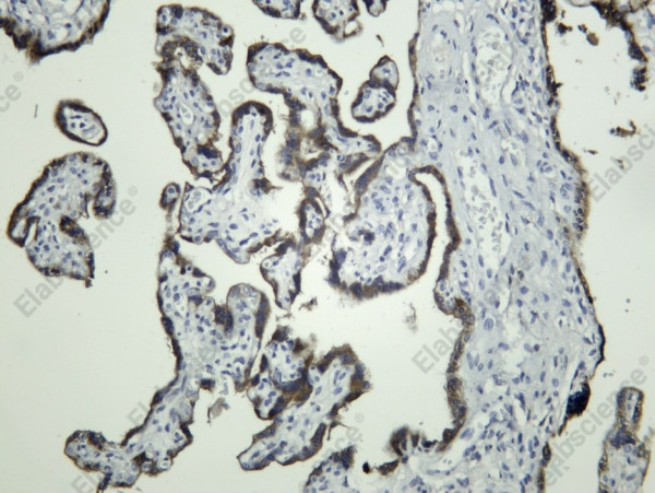 Anti-Recombinant GDF-15, clone C312182