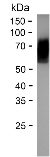 Recombinant Human DERPC Protein