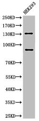 Anti-Cleaved-NOTCH2 (D1733)