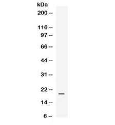 Anti-EG-VEGF / Prokineticin 1