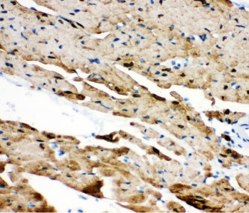 Anti-Phospholamban / PLN