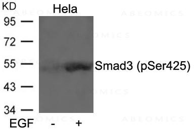 Anti-phospho-Smad3 (Ser425) Antibody