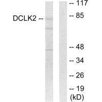 Anti-DCLK2