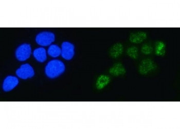 Anti-ALYREF / Tho Complex 4