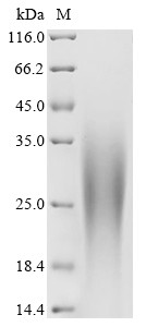 Palmitoyltransferase ZDHHC5 (ZDHHC5), partial, human, recombinant