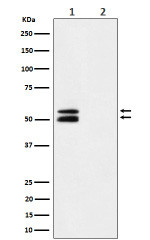 Anti-phospho-CaMKII alpha (T286) / CAMK2A, clone 31C26