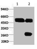 Anti-KRT7 Monoclonal