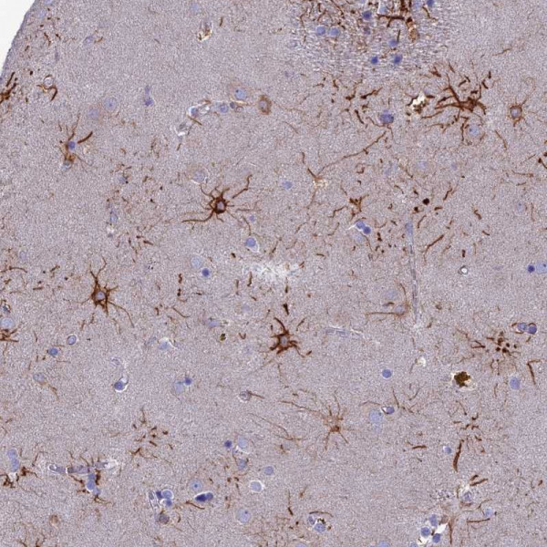 Anti-CYB561D2