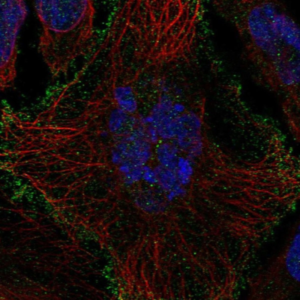 Anti-SLCO1B1